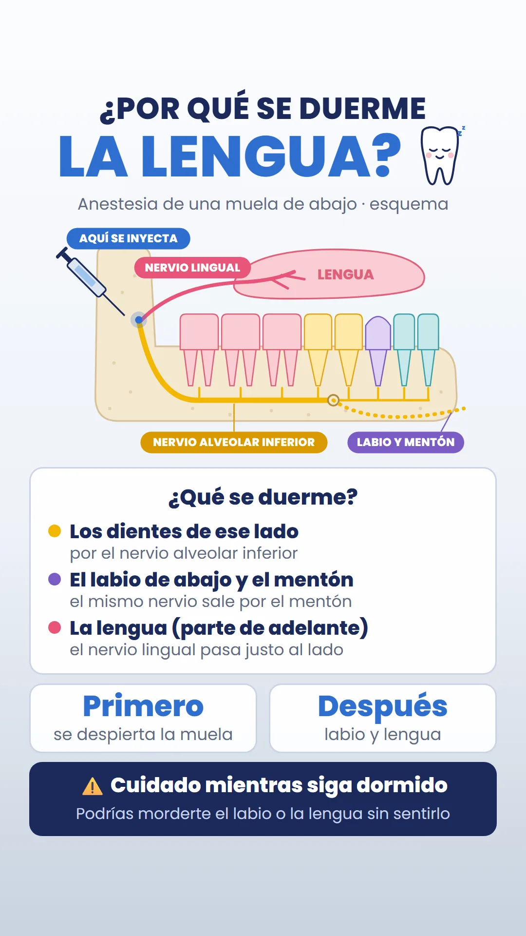 Esquema del nervio alveolar inferior y el nervio lingual